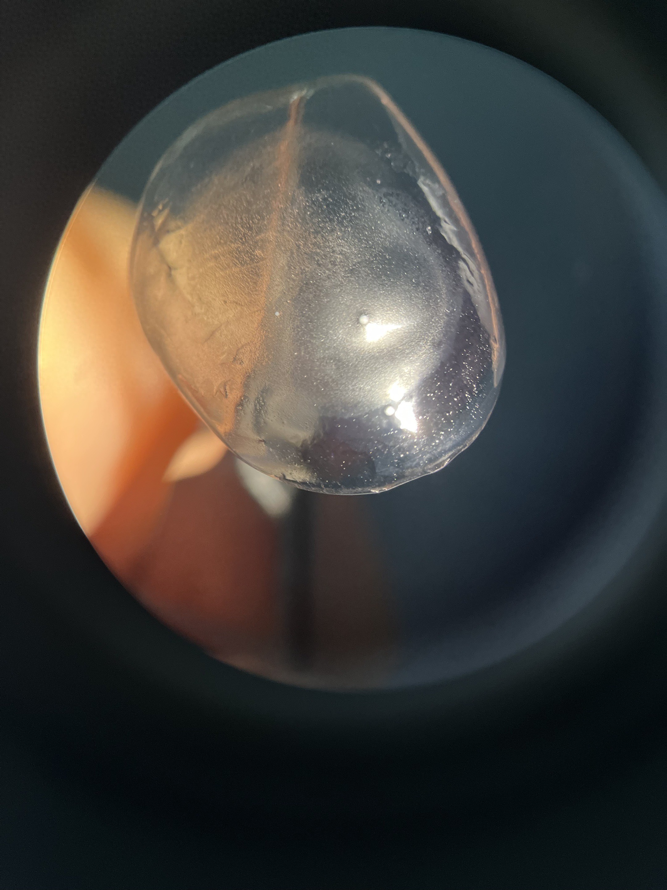 眼睛健康