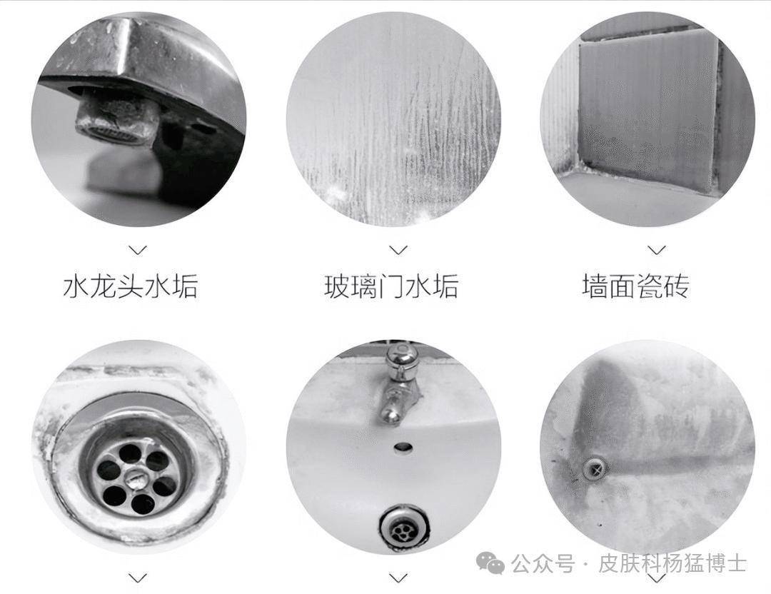 花洒细菌比自来水多100倍！3个月不洗，洗澡等于喷细菌