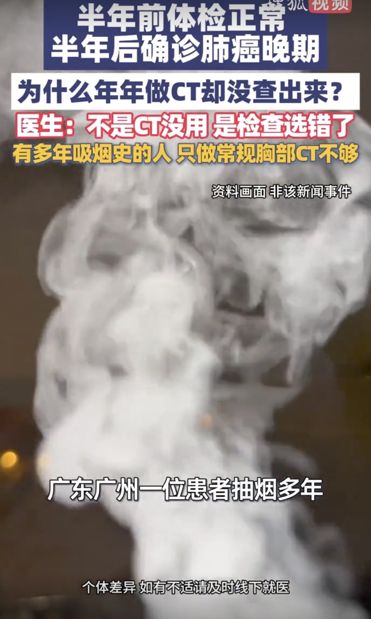 体检年年正常，一查却是癌症晚期？医生：这4项检查才是真正的防癌密码